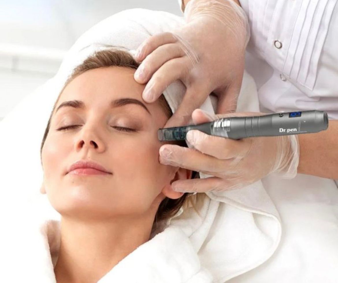 Microneedling